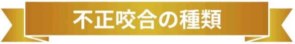 不正咬合の種類